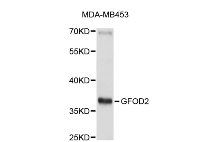 Western Blot - Anti-GFOD2 Antibody (A5015) - Antibodies.com