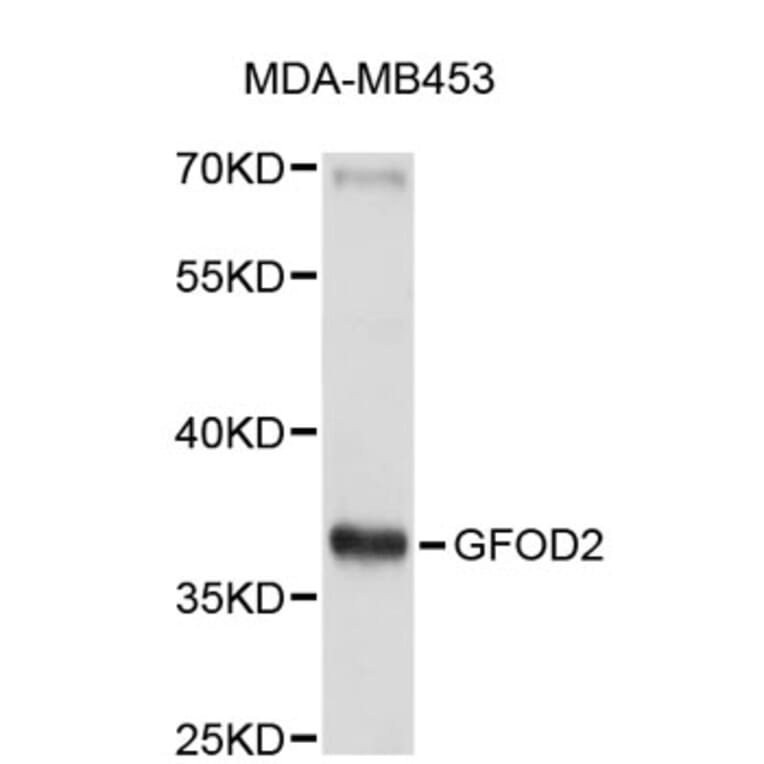Western Blot - Anti-GFOD2 Antibody (A5015) - Antibodies.com