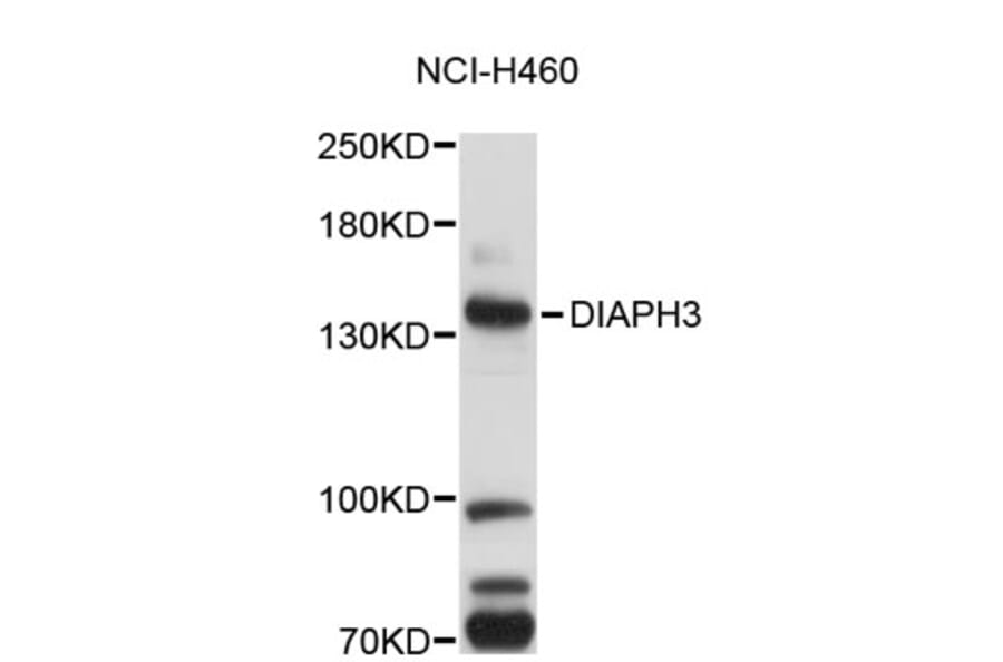 Western Blot - Anti-DIAPH3 Antibody (A5019) - Antibodies.com