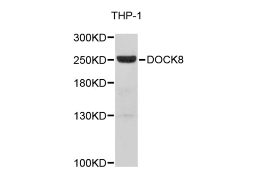 Western Blot - Anti-DOCK8 Antibody (A5021) - Antibodies.com