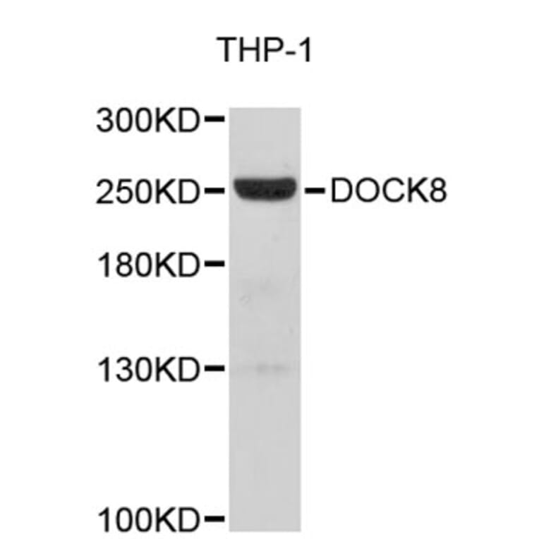 Western Blot - Anti-DOCK8 Antibody (A5021) - Antibodies.com