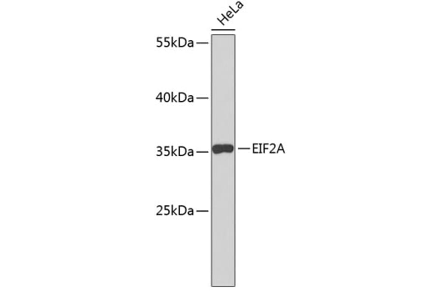 Western Blot - Anti-EIF2A Antibody (A5035) - Antibodies.com