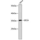 Western Blot - Anti-EIF2A Antibody (A5035) - Antibodies.com
