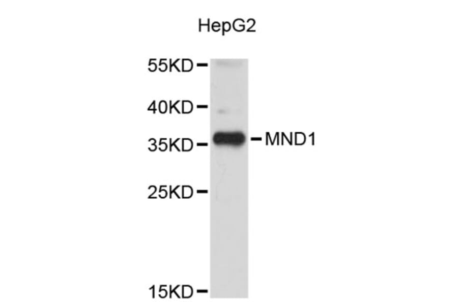 Western Blot - Anti-MND1 Antibody (A5038) - Antibodies.com