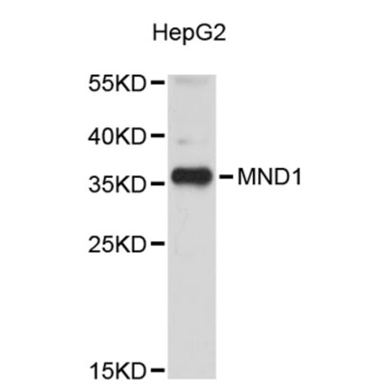 Western Blot - Anti-MND1 Antibody (A5038) - Antibodies.com