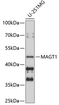 Western blot analysis of extracts of U-251MG cells, using Anti-MAGT1 Antibody (A5039) at 1:1,000 dilution.
Secondary antibody: Goat Anti-Rabbit IgG (H+L) (HRP) (AS014) at 1:10,000 dilution.
Lysates / proteins: 25µg per lane.
Blocking buffer: 3% non-fat dry milk in TBST.
Detection: ECL Basic Kit (RM00020).
Exposure time: 90s.