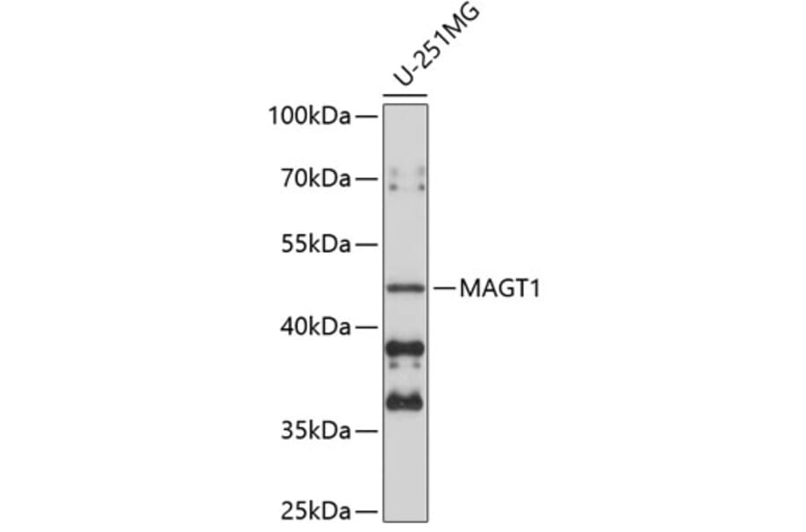 Western Blot - Anti-MAGT1 Antibody (A9635) - Antibodies.com