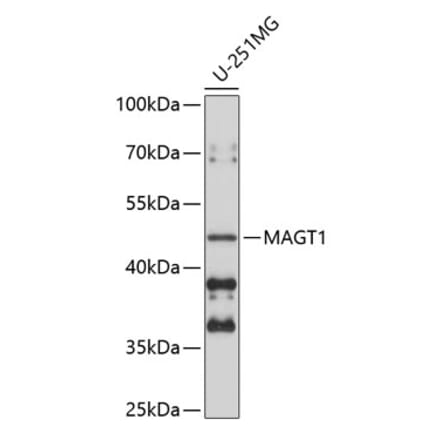 Western Blot - Anti-MAGT1 Antibody (A9635) - Antibodies.com