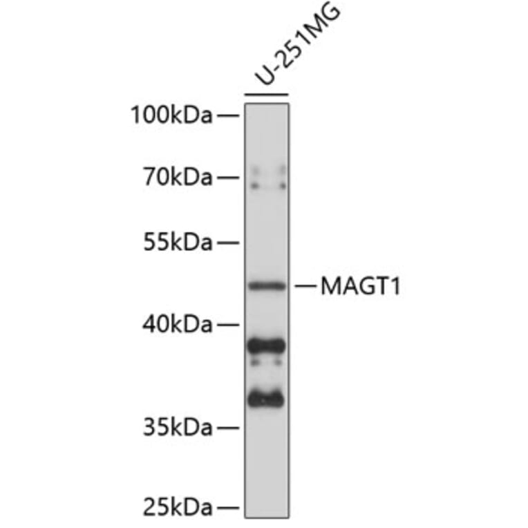 Western Blot - Anti-MAGT1 Antibody (A9635) - Antibodies.com