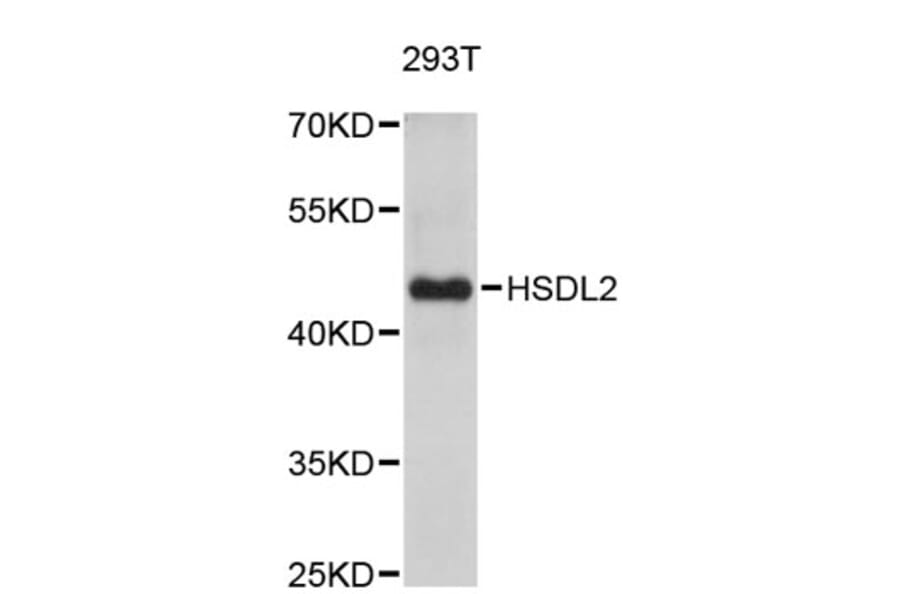 Western Blot - Anti-HSDL2 Antibody (A5047) - Antibodies.com