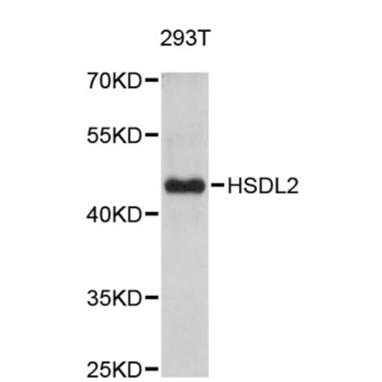 Western Blot - Anti-HSDL2 Antibody (A5047) - Antibodies.com