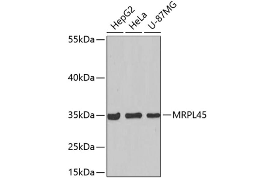 Western Blot - Anti-MRPL45 Antibody (A5052) - Antibodies.com