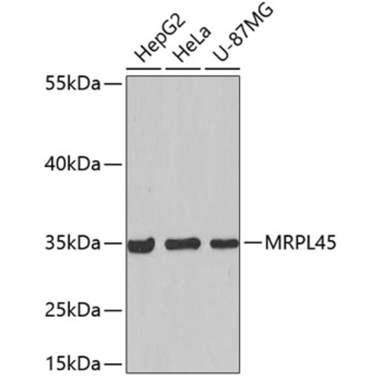 Western Blot - Anti-MRPL45 Antibody (A5052) - Antibodies.com