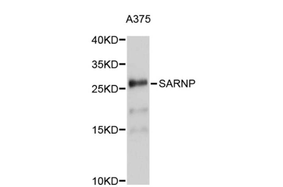 Western Blot - Anti-SARNP Antibody (A5054) - Antibodies.com