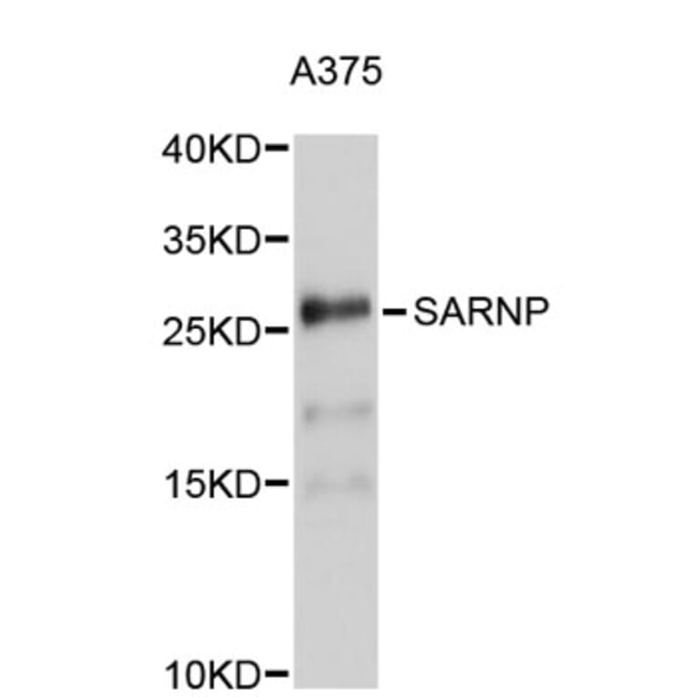 Western Blot - Anti-SARNP Antibody (A5054) - Antibodies.com