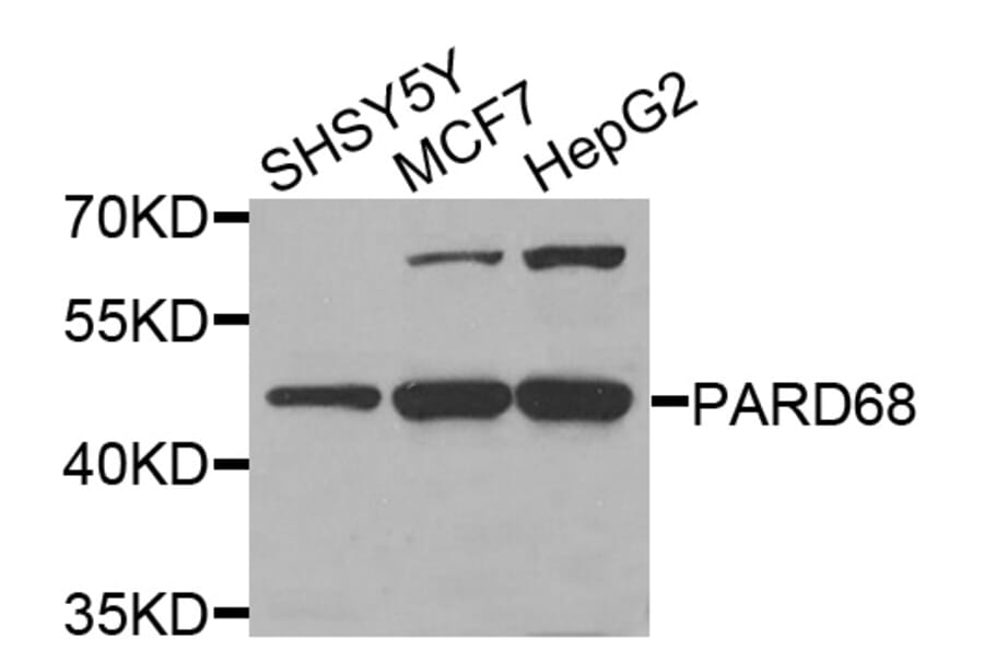 Western Blot - Anti-PARD6B Antibody (A5060) - Antibodies.com