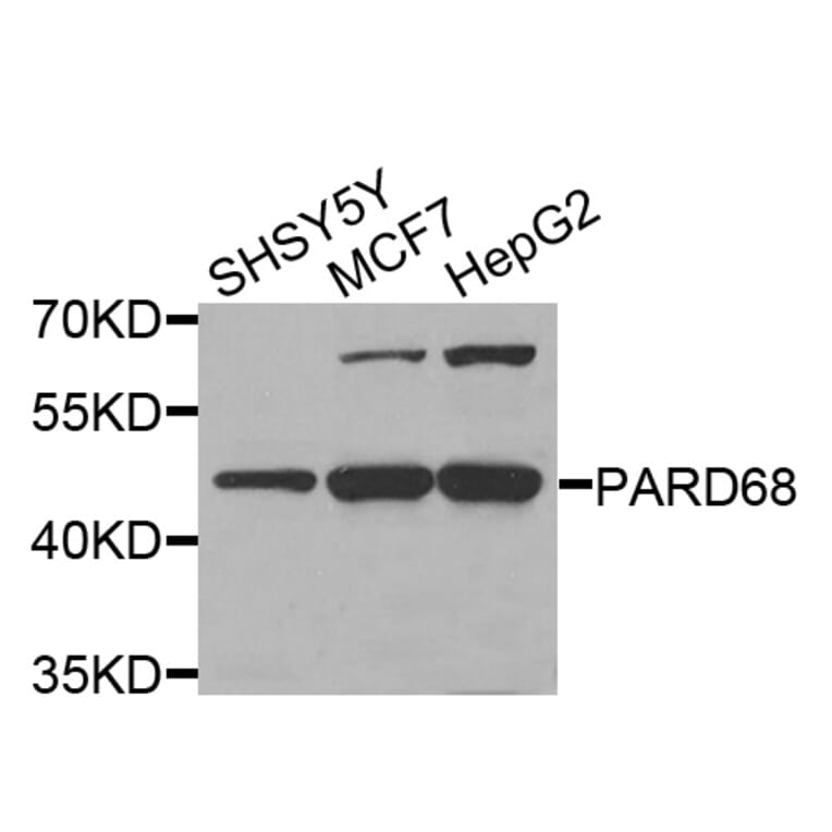 Western Blot - Anti-PARD6B Antibody (A5060) - Antibodies.com