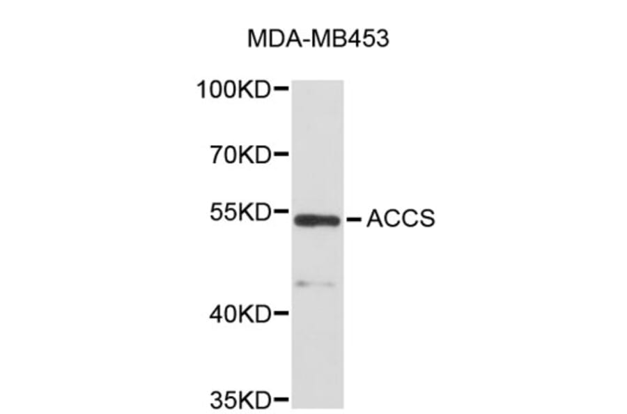 Western Blot - Anti-ACCS Antibody (A5062) - Antibodies.com