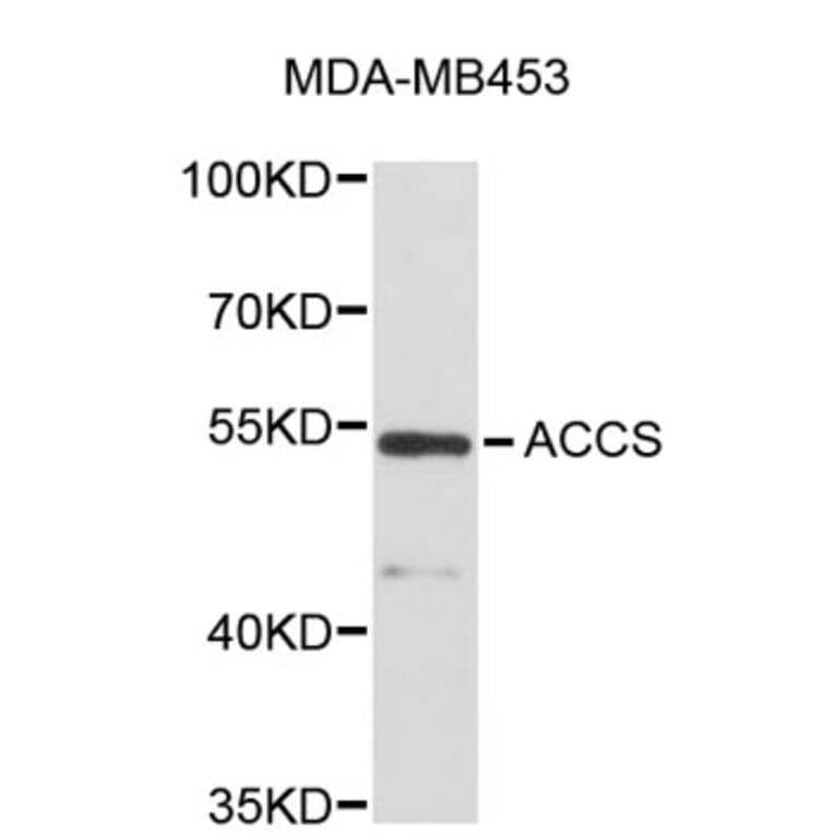Western Blot - Anti-ACCS Antibody (A5062) - Antibodies.com