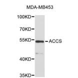Western Blot - Anti-ACCS Antibody (A5062) - Antibodies.com
