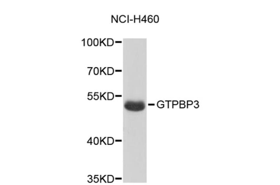 Western Blot - Anti-GTPBP3 Antibody (A5063) - Antibodies.com