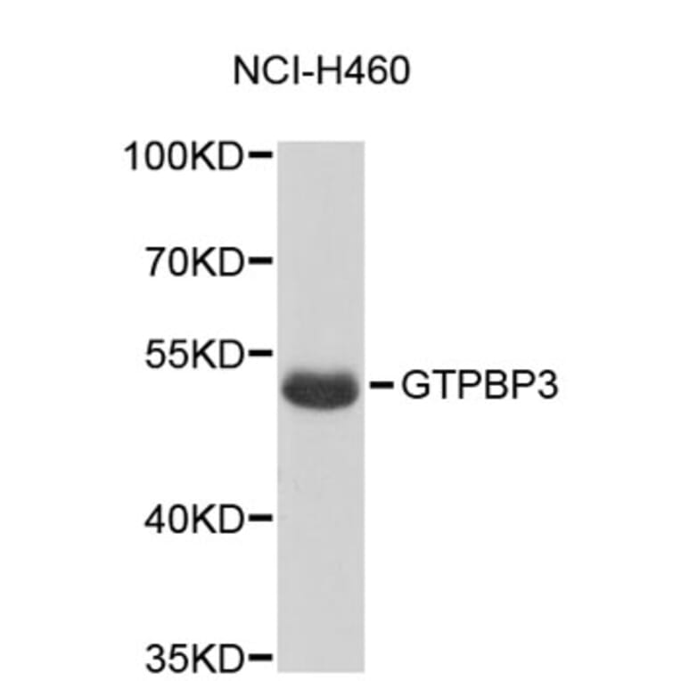 Western Blot - Anti-GTPBP3 Antibody (A5063) - Antibodies.com