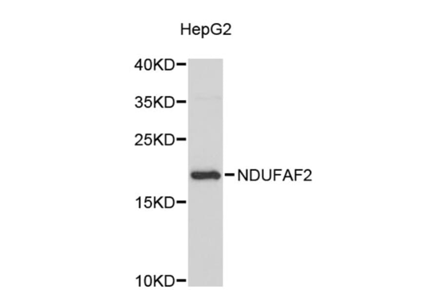 Western Blot - Anti-NDUFAF2 Antibody (A5087) - Antibodies.com