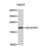 Western Blot - Anti-NDUFAF2 Antibody (A5087) - Antibodies.com