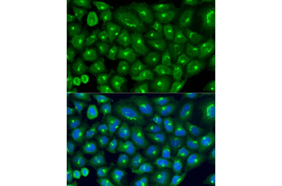 Immunofluorescence - Anti-COG7 Antibody (A9648) - Antibodies.com
