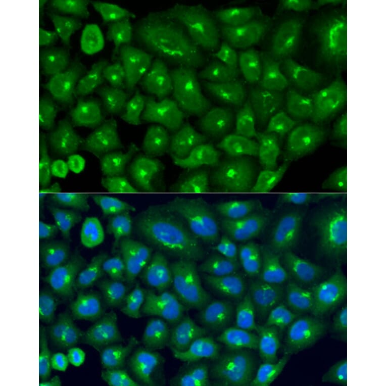 Immunofluorescence - Anti-COG7 Antibody (A9648) - Antibodies.com
