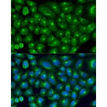 Immunofluorescence - Anti-COG7 Antibody (A9648) - Antibodies.com