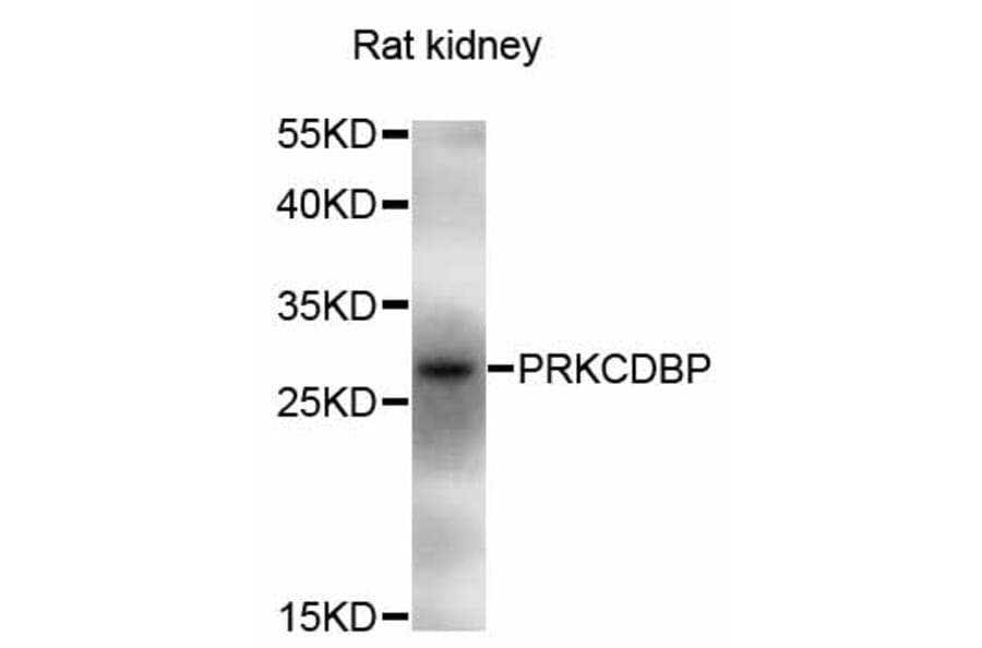 Western Blot - Anti-PRKCDBP Antibody (A5105) - Antibodies.com