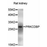 Western Blot - Anti-PRKCDBP Antibody (A5105) - Antibodies.com