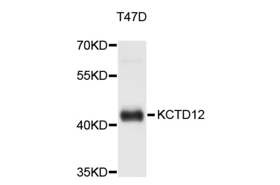 Western Blot - Anti-KCTD12 Antibody (A5116) - Antibodies.com