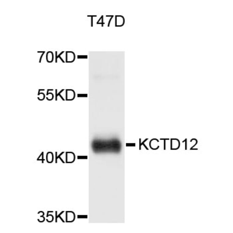 Western Blot - Anti-KCTD12 Antibody (A5116) - Antibodies.com