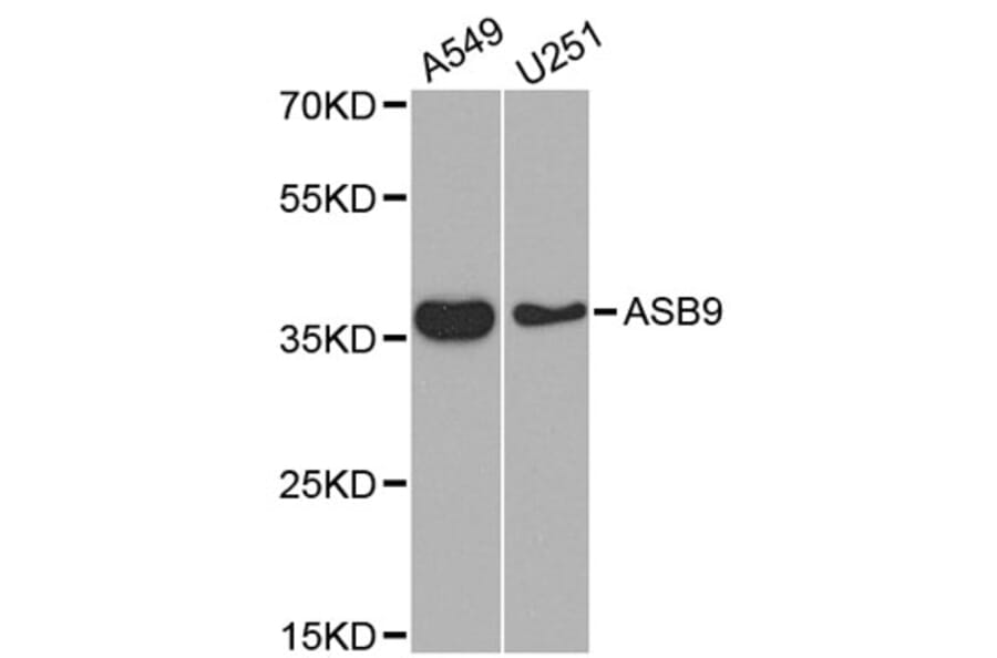 Western Blot - Anti-ASB9 Antibody (A5156) - Antibodies.com