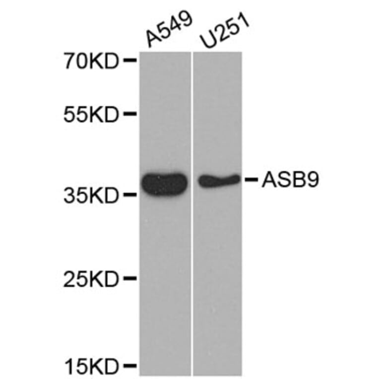 Western Blot - Anti-ASB9 Antibody (A5156) - Antibodies.com