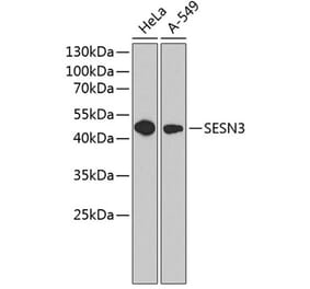 Western Blot - Anti-SESN3 Antibody (A9667) - Antibodies.com