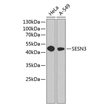 Western Blot - Anti-SESN3 Antibody (A9667) - Antibodies.com