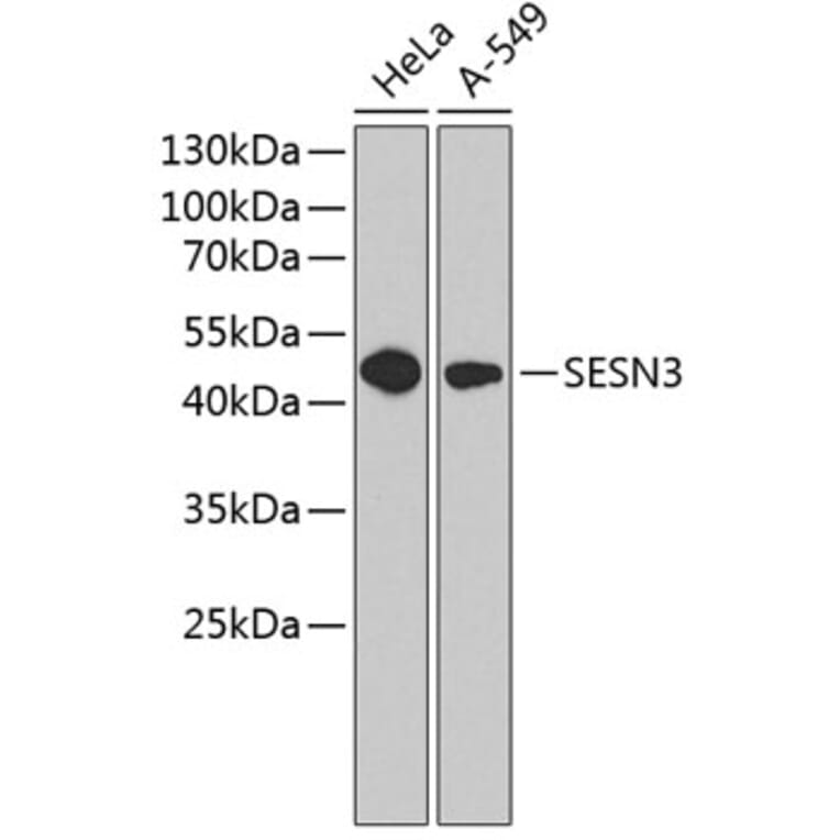 Western Blot - Anti-SESN3 Antibody (A9667) - Antibodies.com