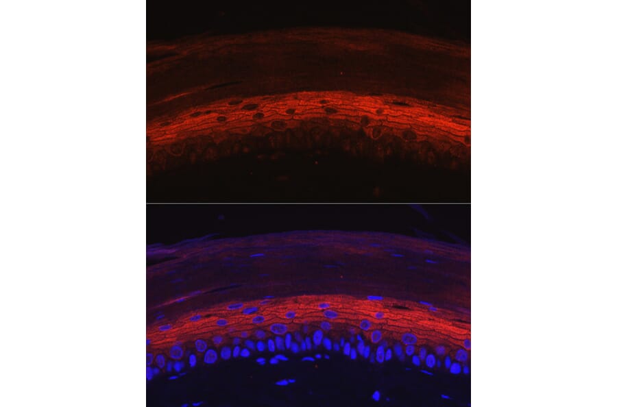 Immunofluorescence - Anti-K80 Antibody (A9668) - Antibodies.com