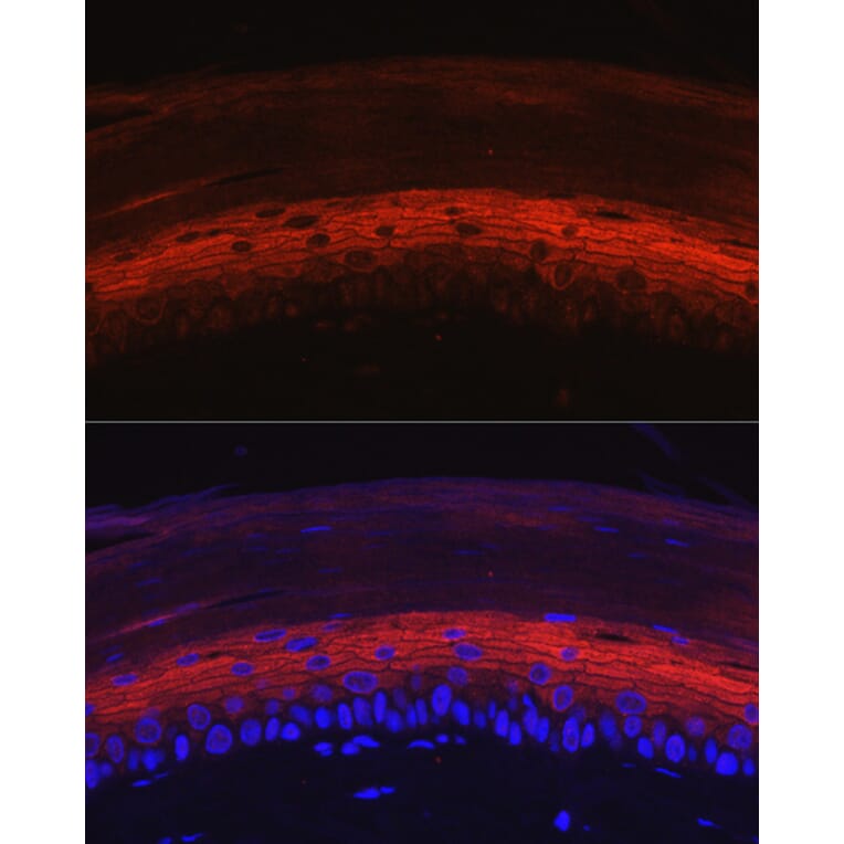 Immunofluorescence - Anti-K80 Antibody (A9668) - Antibodies.com