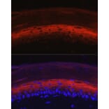 Immunofluorescence - Anti-K80 Antibody (A9668) - Antibodies.com
