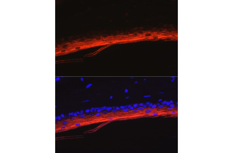 Immunofluorescence - Anti-K80 Antibody (A9668) - Antibodies.com
