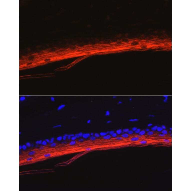 Immunofluorescence - Anti-K80 Antibody (A9668) - Antibodies.com