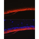 Immunofluorescence - Anti-K80 Antibody (A9668) - Antibodies.com