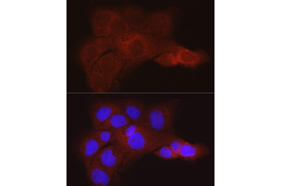 Immunofluorescence - Anti-K80 Antibody (A9668) - Antibodies.com