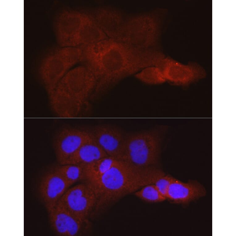 Immunofluorescence - Anti-K80 Antibody (A9668) - Antibodies.com