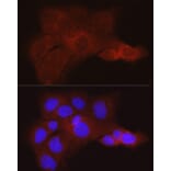 Immunofluorescence - Anti-K80 Antibody (A9668) - Antibodies.com