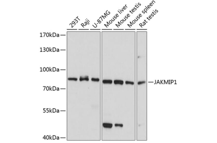 Western Blot - Anti-JAKMIP1 Antibody (A5178) - Antibodies.com